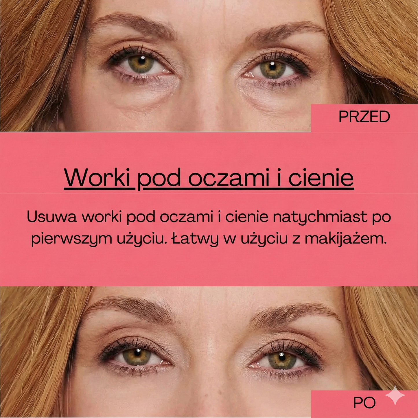 Pheroeli™ – Szemkörnyék- és ránctalanító krém