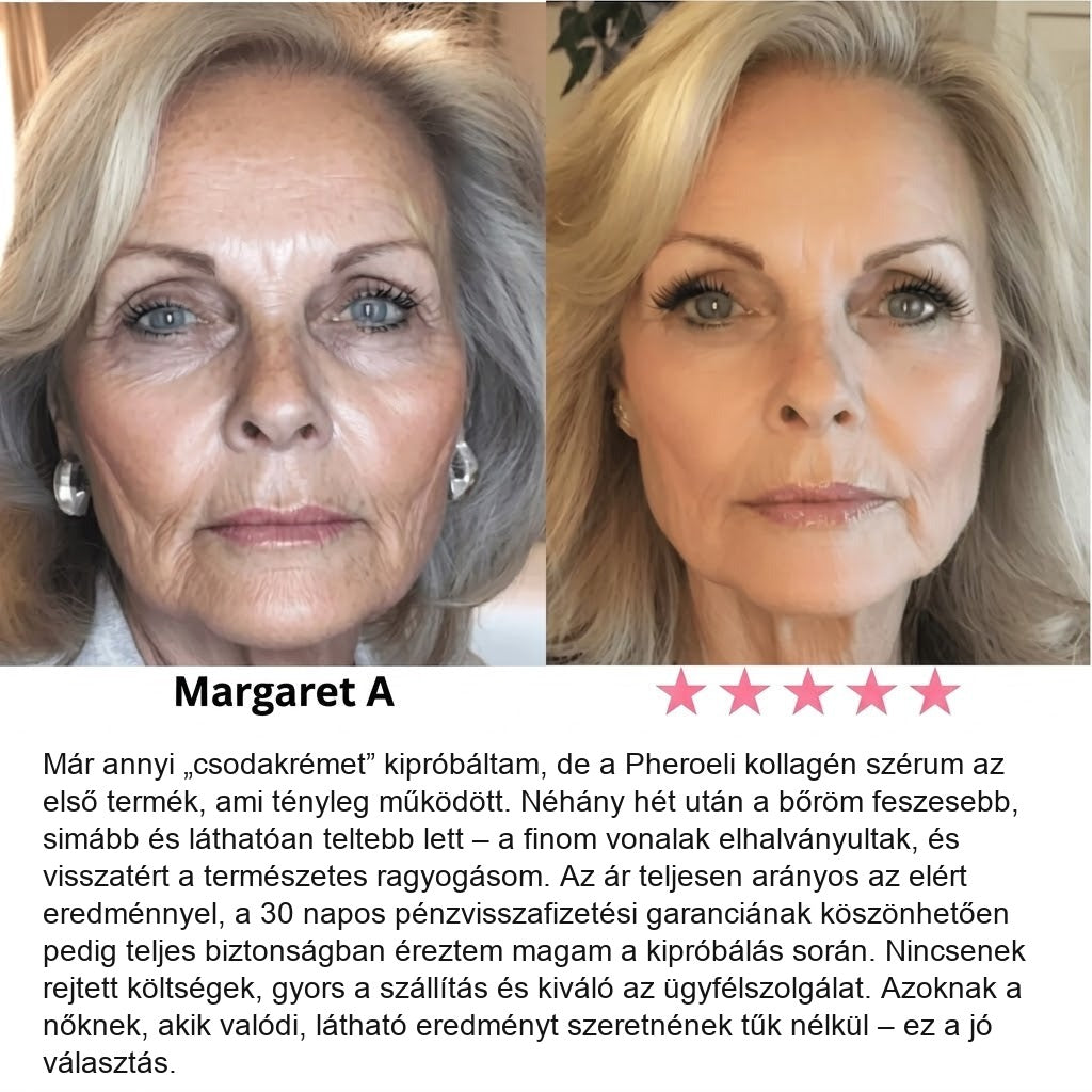 Serum Collagen